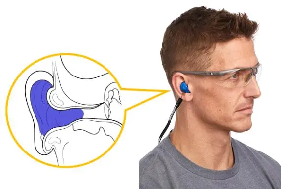 EarzON-EarDiagram